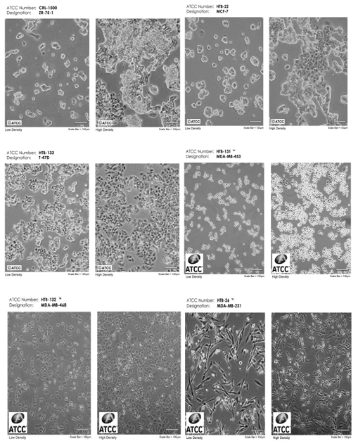 Comprehensive Review of Breast Cancer Cell Lines: A Guide to Selecting ...